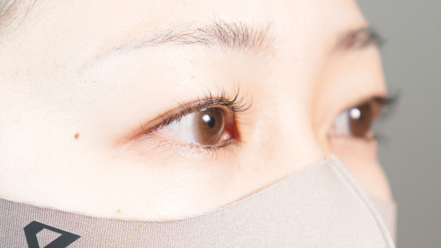 手術前の状態 その1