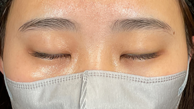 手术前的状态 其一