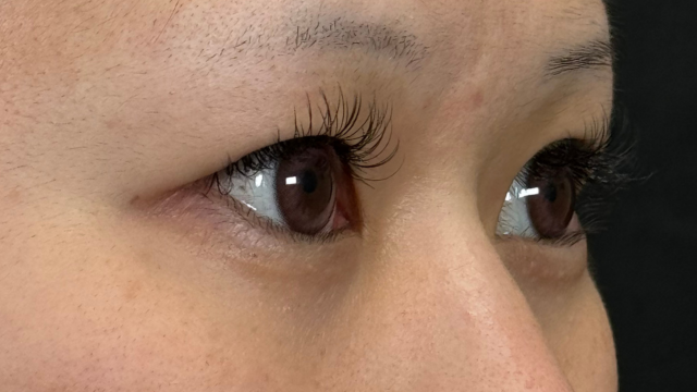 手术前的状态 其一