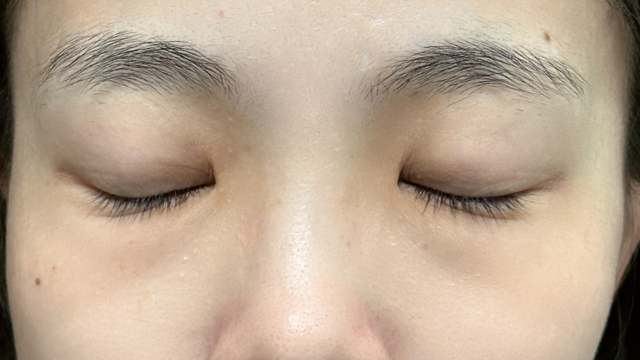 手术前的状态 其一