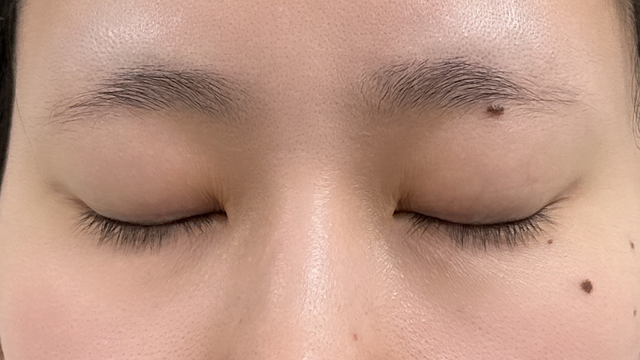 Postoperative Condition Part 1