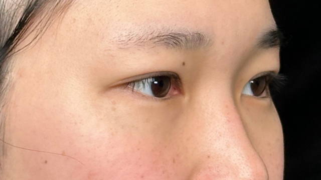 Postoperative Condition Part 1