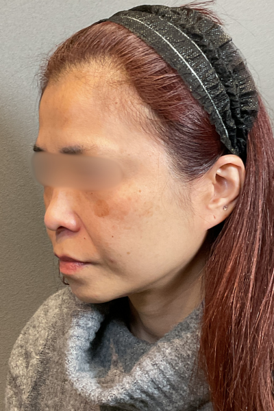 Postoperative Condition Part 1