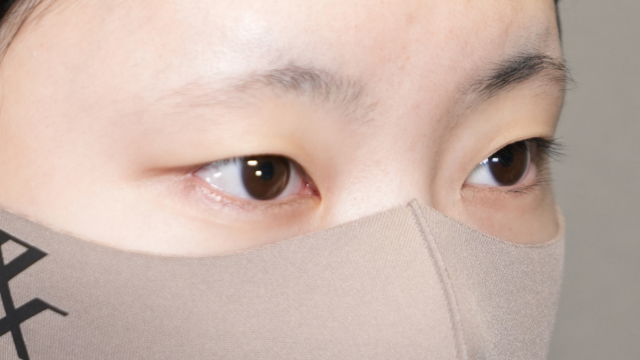 手术前的状态 其一