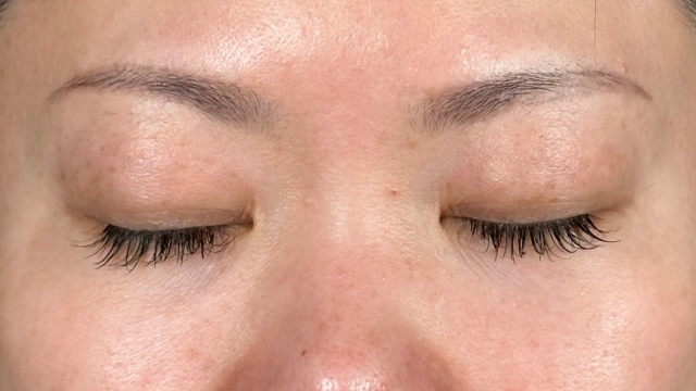 手术前的状态 其一