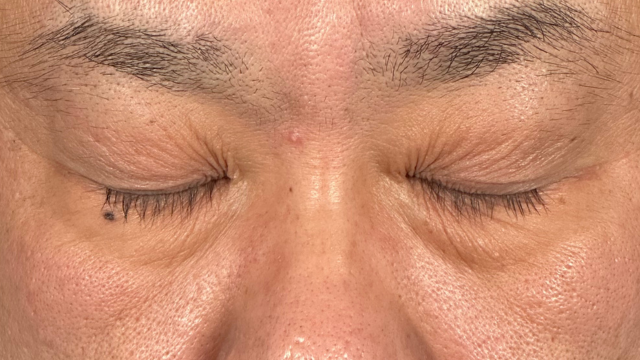 Postoperative Condition Part 1