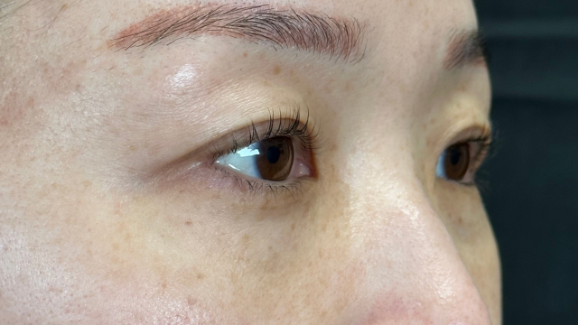 手術前の状態 その1