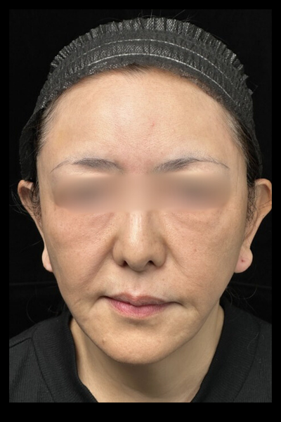 手術前の状態 その1