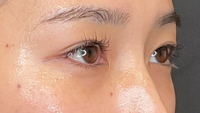 手术前的状态 其一