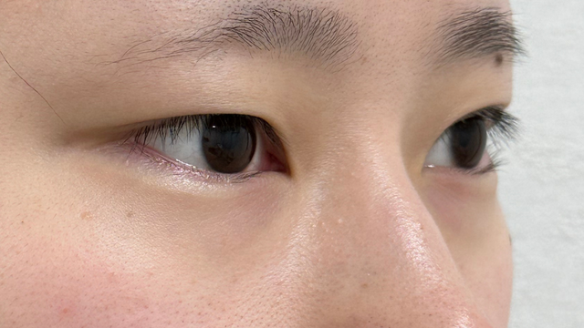 Postoperative Condition Part 1