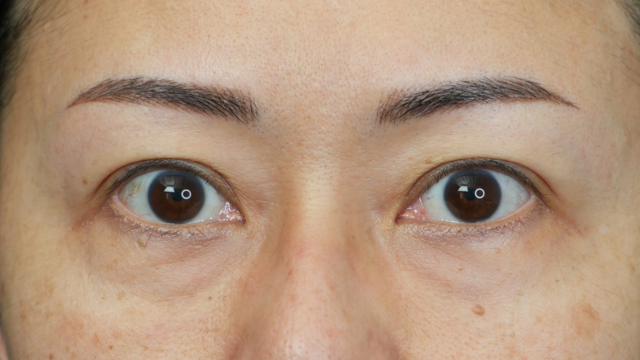 Postoperative Condition Part 1