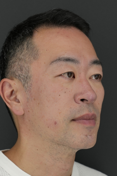 手術前の状態 その1