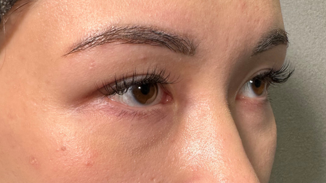 手术前的状态 其一