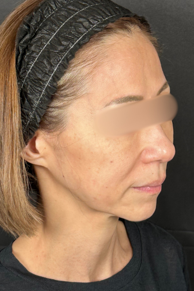 手術前の状態 その1