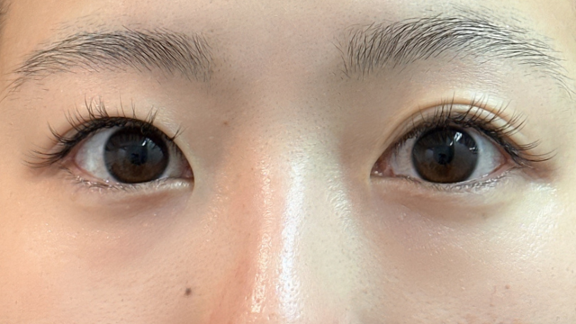 手術前の状態 その1