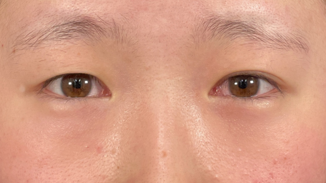 Postoperative Condition Part 1