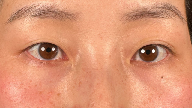 手术前的状态 其一