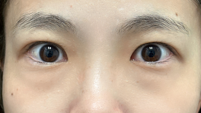 手术前的状态 其一