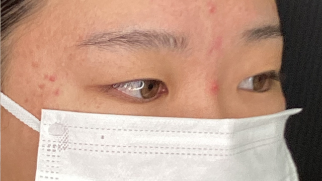 手術前の状態 その1