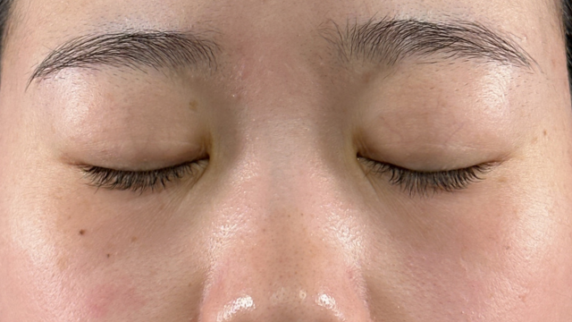 Postoperative Condition Part 1