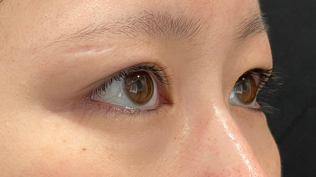 Postoperative Condition Part 1