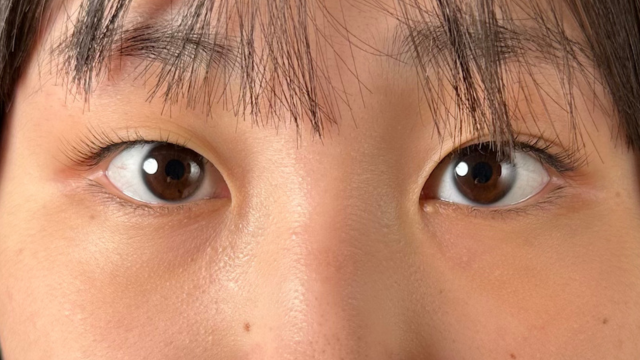 手术前的状态 其一