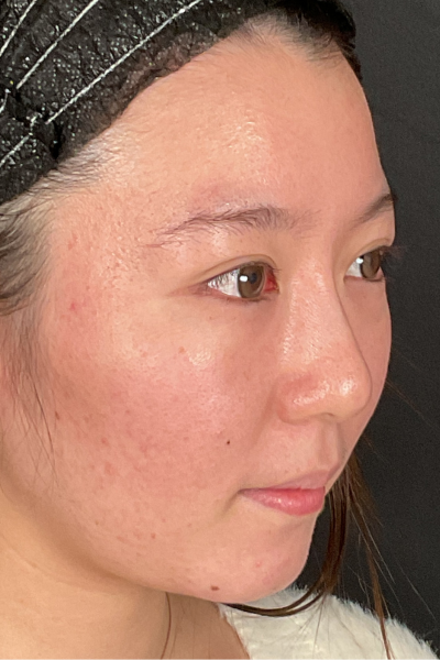 手術前の状態 その1