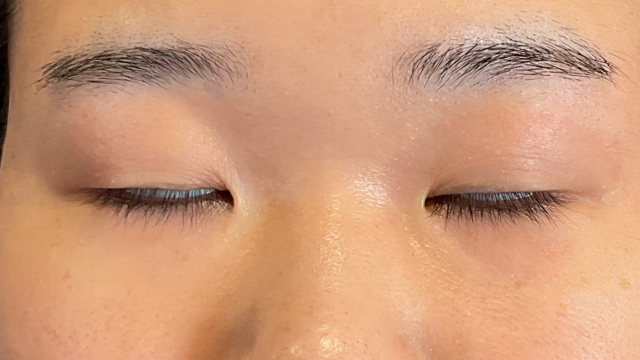 Postoperative Condition Part 1