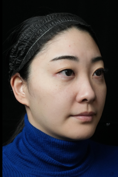 手术前的状态 其一