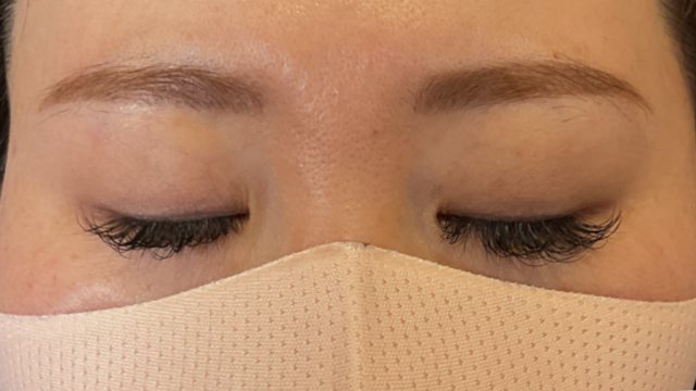 手术前的状态 其一