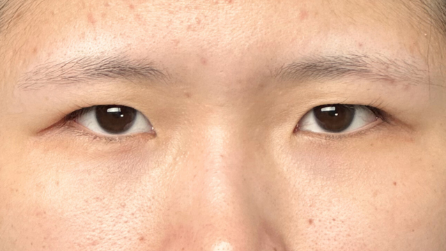 Postoperative Condition Part 1