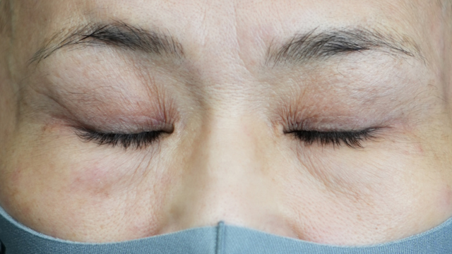 手术前的状态 其一