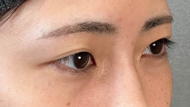 Postoperative Condition Part 1