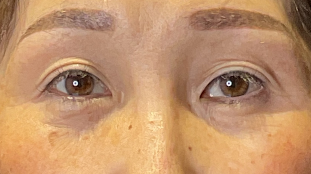 手术前的状态 其一