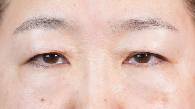 Postoperative Condition Part 1