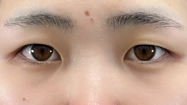 Postoperative Condition Part 1