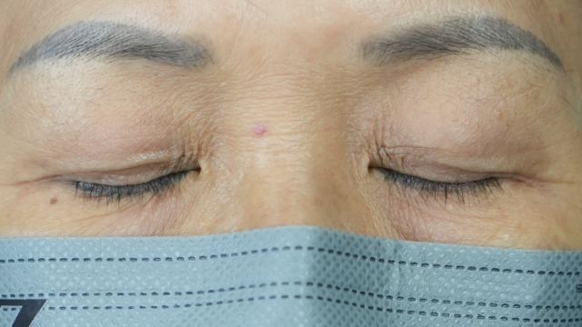 手术前的状态 其一