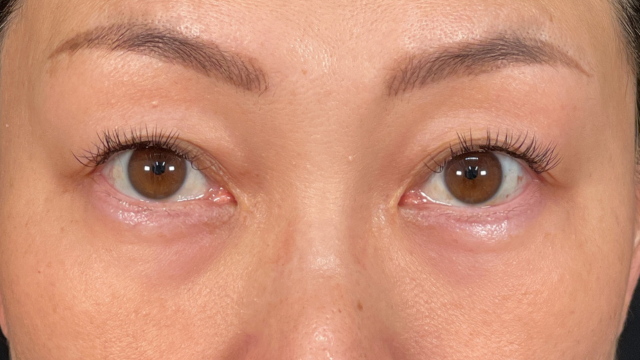 Postoperative Condition Part 1