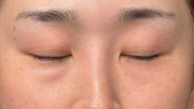 手术前的状态 其一