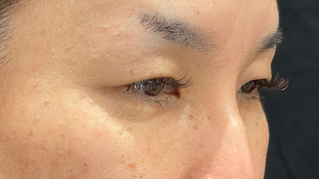 手术前的状态 其一