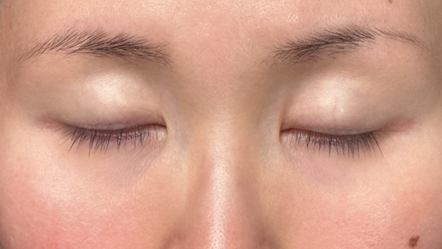 Postoperative Condition Part 1