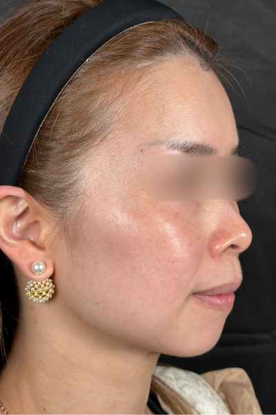 Postoperative Condition Part 1