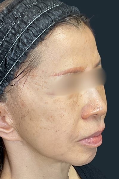 手術前の状態 その1