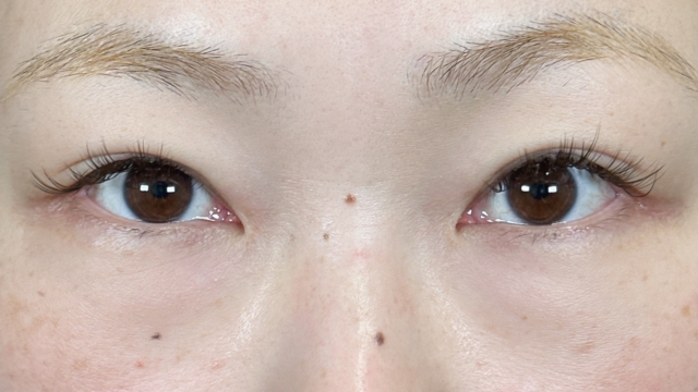 手术前的状态 其一