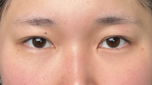 Postoperative Condition Part 1