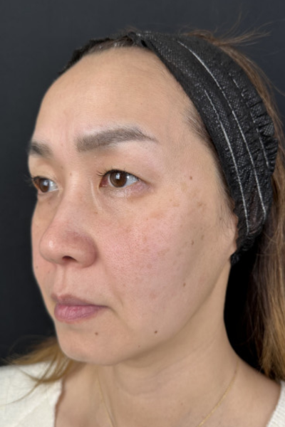 手术前的状态 其一