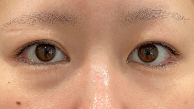 Postoperative Condition Part 1