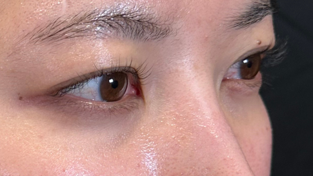 手術前の状態 その1