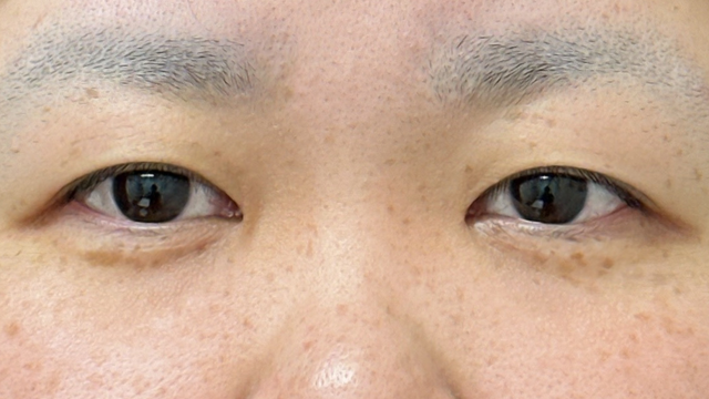 Postoperative Condition Part 1