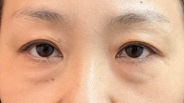 Postoperative Condition Part 1